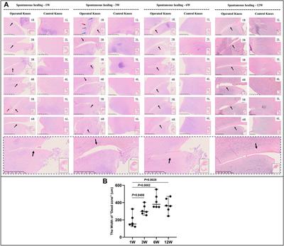 Histologically Confirmed Recellularization is a Key Factor that Affects Meniscal Healing in Immature and Mature Meniscal Tears